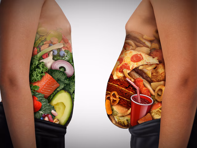 world obesity day 2024 risks preventions 2024 03 2cb5ed9d2076b380e21b6f4f43aa414d
